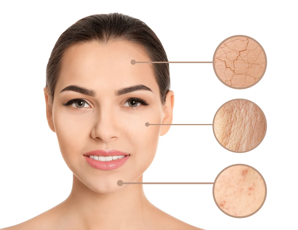 Nahaufnahme eines Gesichts mit drei vergrößerten Details, die verschiedene Hautzustände zeigen: trocken und rissig, akne sowie mit roten Unreinheiten, zur Veranschaulichung der Wirkung von “Nano Glow 3D” Hautpflege.